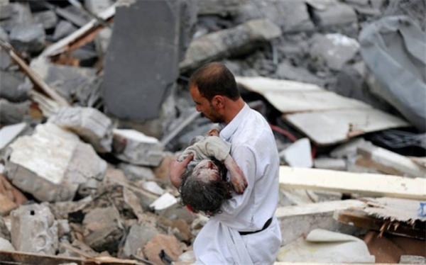 آمار تلفات در یمن: 2400 روز جنگ، 44هزار کشته و زخمی